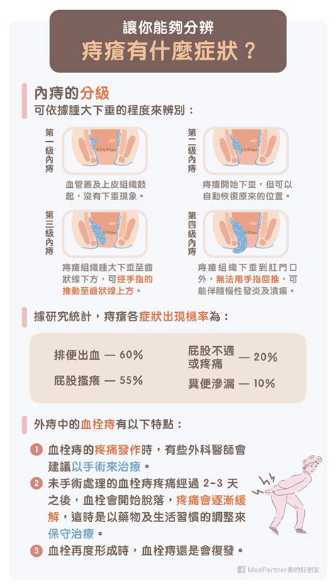 為什麼會長痔|痔瘡怎麼產生？有什麼症狀？如何預防治療？醫師完整圖文解說｜ 